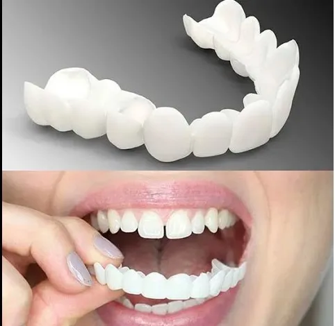 Виниры Snap On Smile